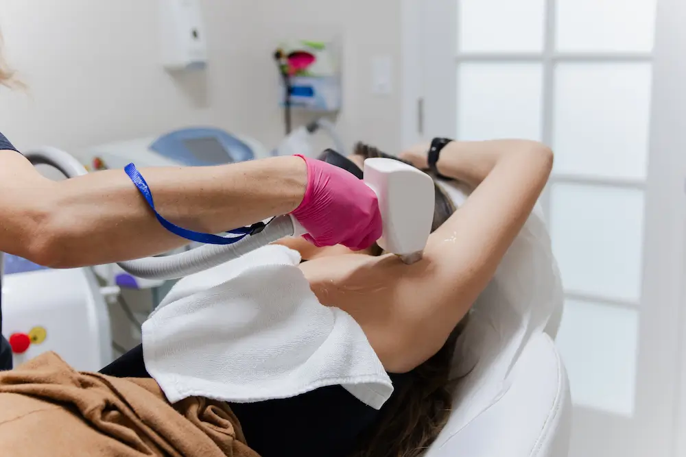 A person receives laser hair removal on their armpit in a clinical setting. Another person performs the procedure, wearing pink gloves.